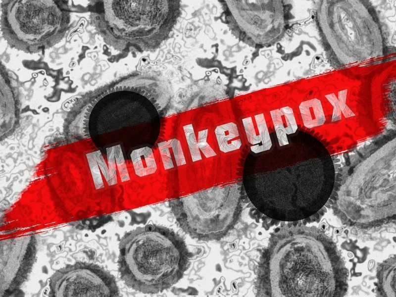 DHS Identifies Second Case Of Monkeypox In A Wisconsin Resident