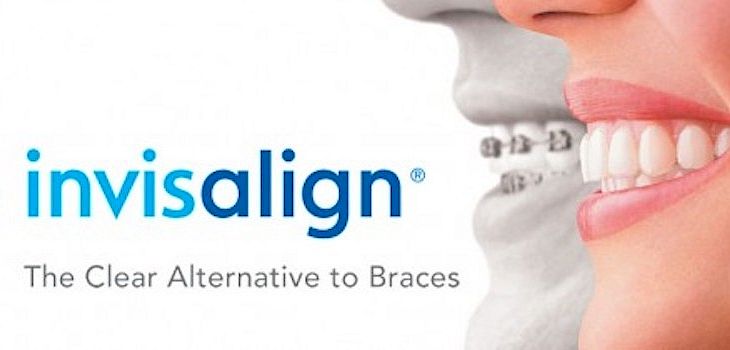 Ask the Dentist: How Will Invisalign Affect My Life?