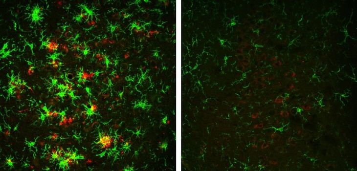 Study: Alzheimer's Disease Reversed in Mouse Model
