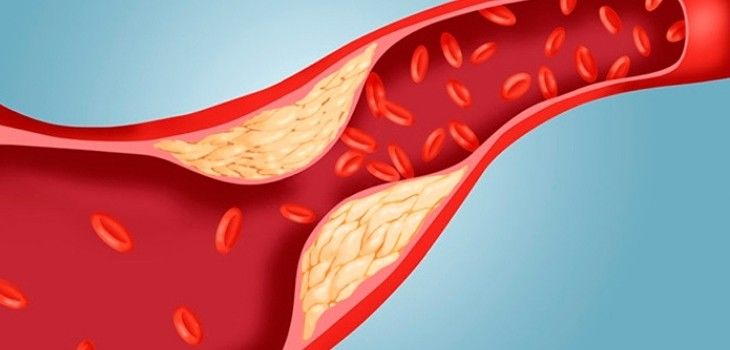 Healthy Minute: 'Good vs. Bad Cholesterol'